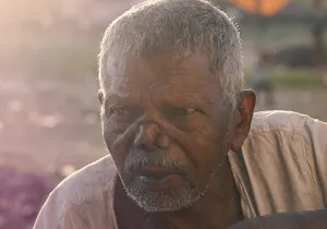 Fotografía: pxhere Retrato hombre con lepra