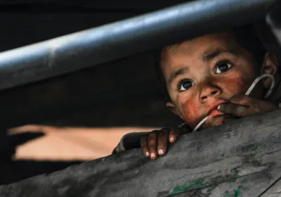 Niños en riesgo de desnutrición en Guatemala