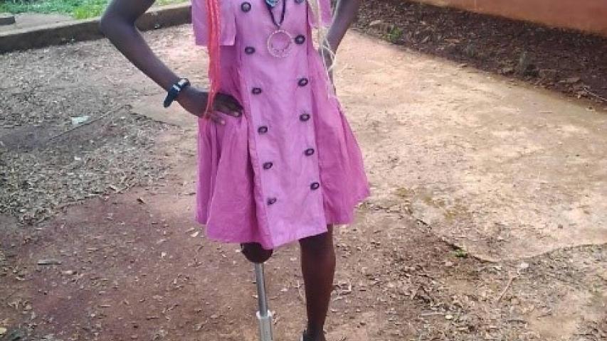 Joven que podrá recibir una de las prótesis en 3D en Camerún.